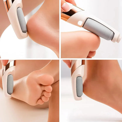 Rechargeable Electric Foot File – Callus Remover with Dual Rollers