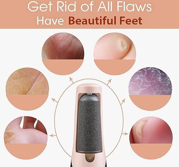 Rechargeable Electric Foot File – Callus Remover with Dual Rollers