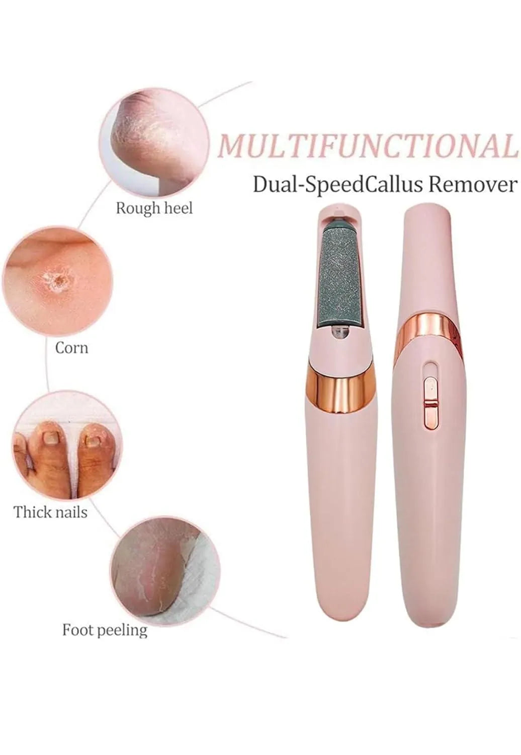 Rechargeable Electric Foot File – Callus Remover with Dual Rollers